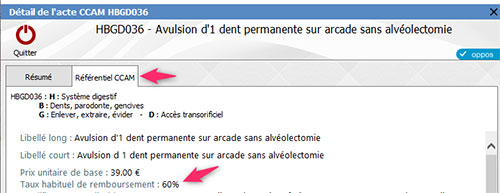 Détail d'un acte CCAM dentaire